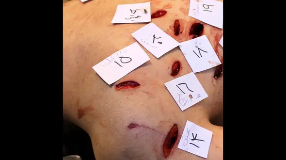 عکس ها حاوی صحنه های دلخراش / بدن‌هایی که با قمه، دشنه و چاقو‌های بلند سوراخ‌سوراخ شده‌اند