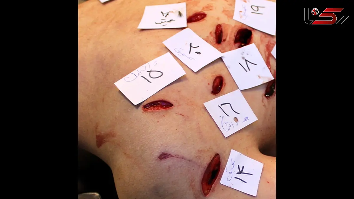 عکس ها حاوی صحنه های دلخراش / بدن‌هایی که با قمه، دشنه و چاقو‌های بلند سوراخ‌سوراخ شده‌اند