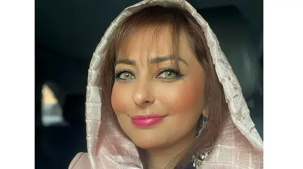 گرانترین گربه جهان برای نفیسه روشن ! + عکس یک چشم رنگی گربه پرشین !