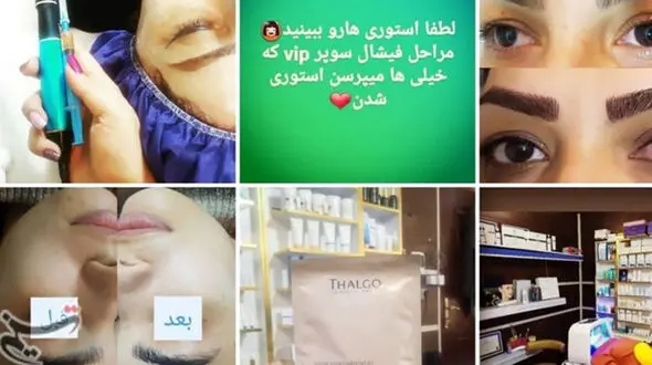 هشدار به زنان / مراقب ژل های زیبایی فاسد باشید