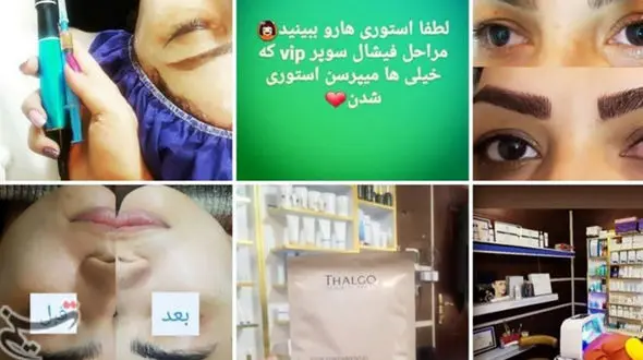 دختر تهرانی یک شبه زشت شد/ می خواست شبیه خواننده ترکیه‌ای شود 