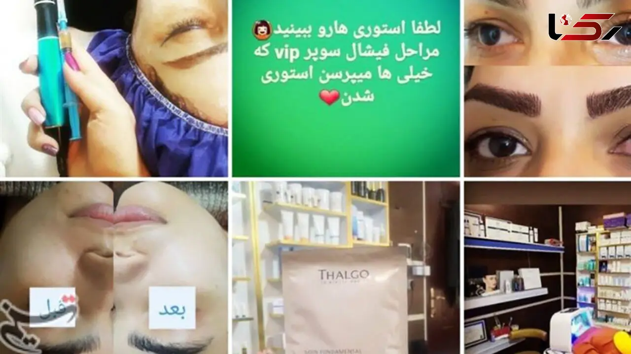 دختر تهرانی یک شبه زشت شد/ می خواست شبیه خواننده ترکیه‌ای شود 