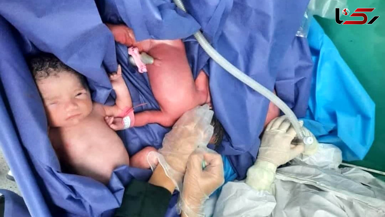 مادرکرونایی در بیمارستان امام رضا(ع) ۳ قلو به دنیا آورد