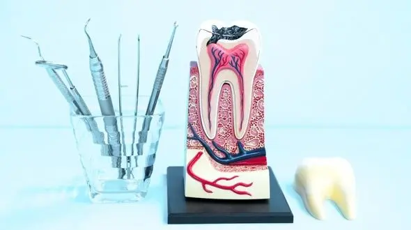 قیمت عصب ‌کشی دندان در شرق تهران چقدر است؟