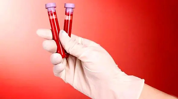 شایع ترین نوع کم خونی چیست؟