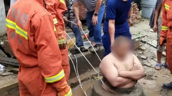 شکم بزرگ جان یک مرد را از مرگ نجات داد !+ عکس