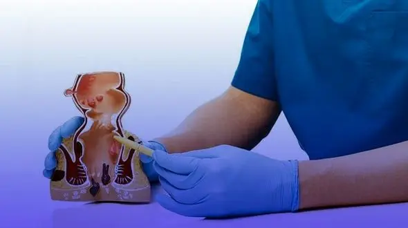 آیا برای درمان شقاق حتماً باید به دکتر مراجعه کرد؟