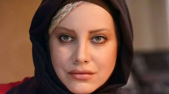 تغییر چهره شراره رخام / خانم بازیگر را دیگر نمیتوان شناخت !