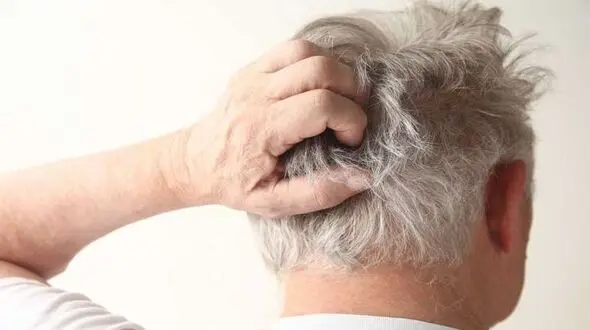 بیماری هایی که عامل خارش پوست سر است