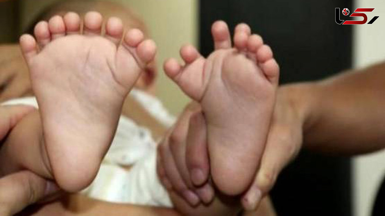 عکس / تولد یک نوزاد با 31 انگشت