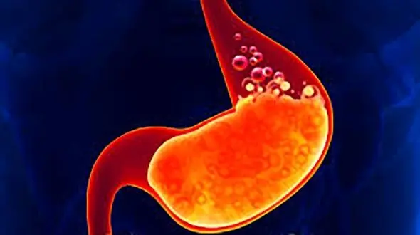 درمان خانگی معده سرد