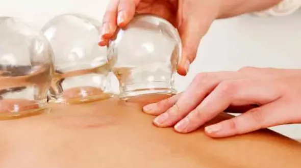 کرونایی ها برای تقویت بدن حجامت کنند