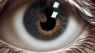 چشم های این زن همه را ترساند / عجیب الخلقه ترین چشم جهان را ببینید ! + عکس ها