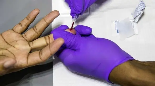 همه آنچه باید درباره بیماری ایدز بدانید + راه های انتقال