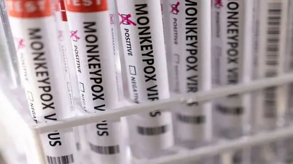 آبله میمون ادامه دارد/شناسایی 2 بیمار جدید در فیلیپین