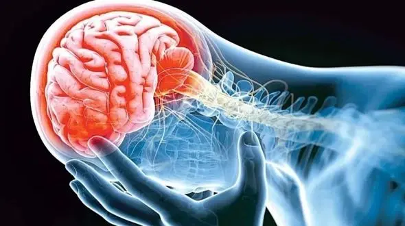 سکته هشدار دهنده چیست؟ علائم و درمان فوری