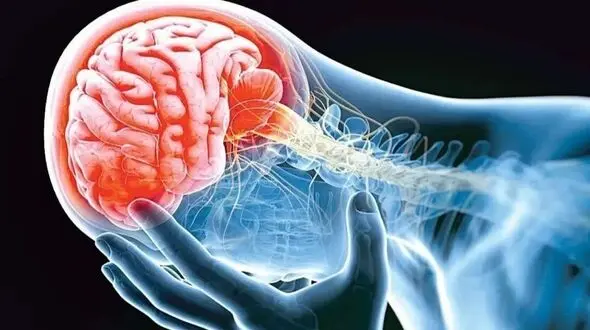 سکته هشدار دهنده چیست؟ علائم و درمان فوری