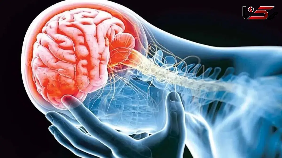 سکته هشدار دهنده چیست؟ علائم و درمان فوری