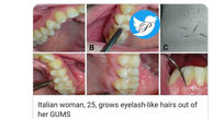 حادثه ای عجیب /  دندان های یک زن ایتالیایی مژه درآورد + عکس