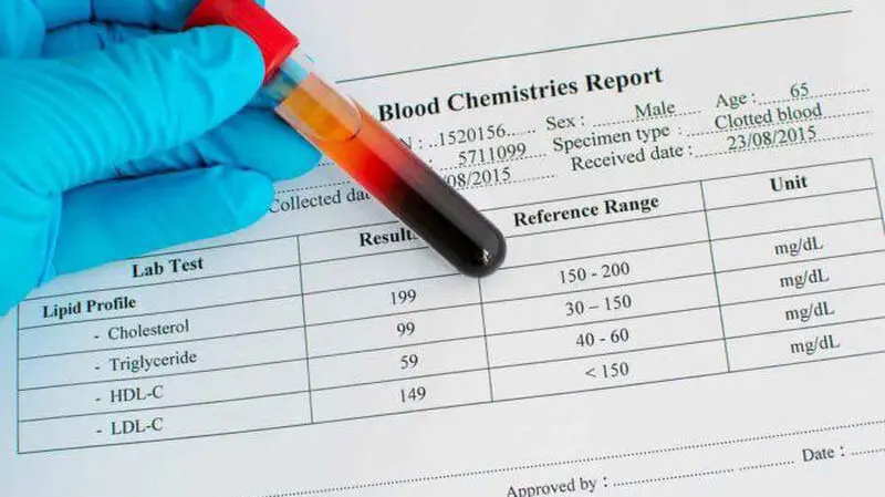 cholesterol-700x467-min