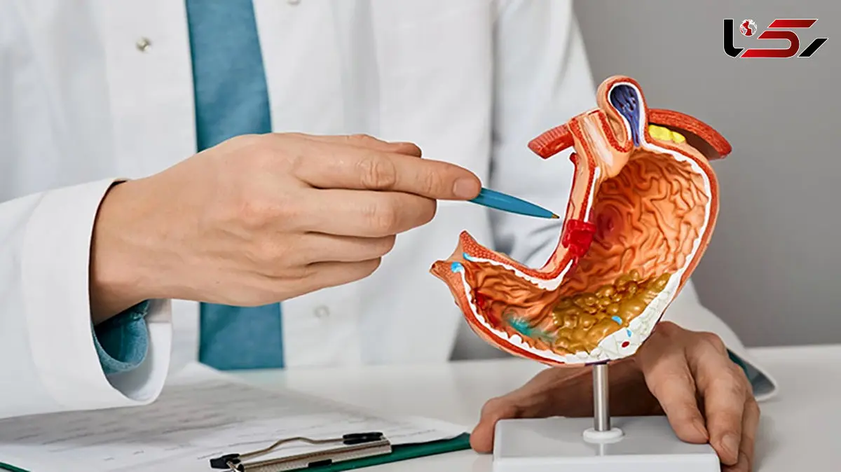 «بستن رگ اشتها» افسانه‌ای خطرناک؛ هشدار جراحان درباره مسدود شدن مسیر درمان چاقی