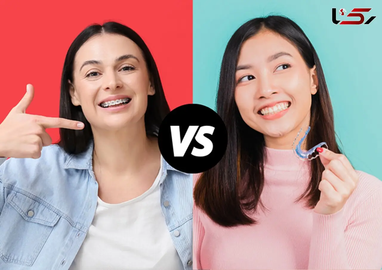 ارتودنسی متحرک بهتر است یا ارتودنسی ثابت؟