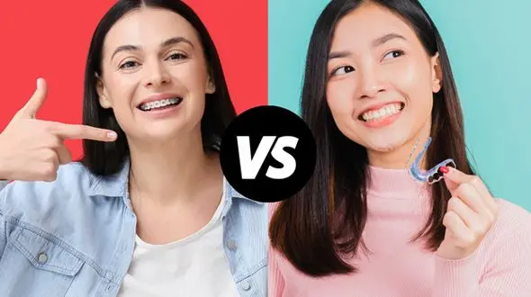 ارتودنسی متحرک بهتر است یا ارتودنسی ثابت؟