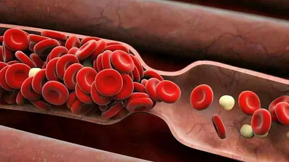 درمان غلظت خون + فیلم