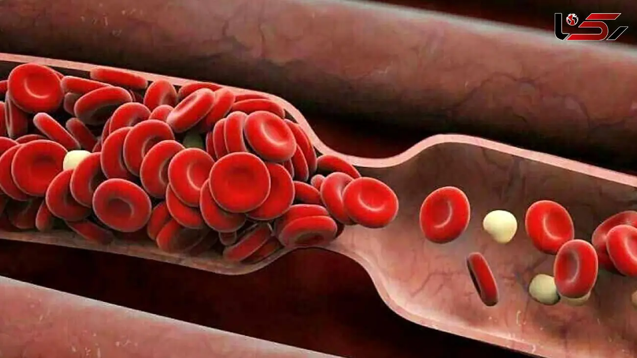 درمان غلظت خون + فیلم