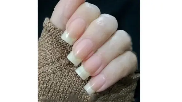 ناخن‌ها هم سرما می‌خورند !