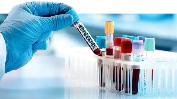 سلامت در دولت دوازدهم از سبد خانوار حذف شد