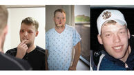 مردی بعد از ده سال از اصابت گلوله به صورتش قیافه جدیدی پیدا کرد +تصاویر 