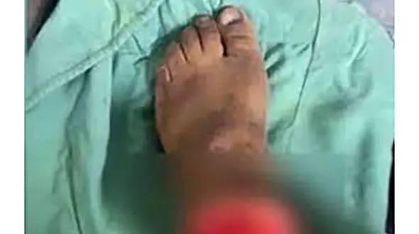  کشف پای قطع شده  زن جوان در کهریزک تهران / امروز عصر رخ داد