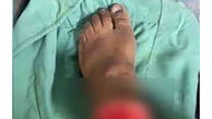  کشف پای قطع شده  زن جوان در کهریزک تهران / امروز عصر رخ داد