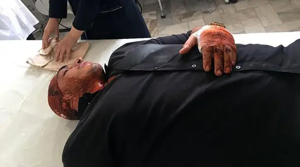 حمله اوباش تهرانی به قهرمان بوکس المپیکی ایران + جزئیات و عکس