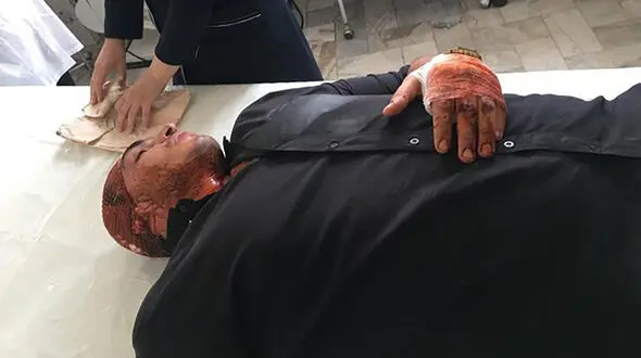 حمله اوباش تهرانی به قهرمان بوکس المپیکی ایران + جزئیات و عکس