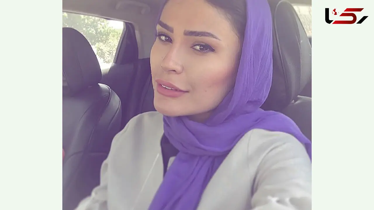 عکس صورت شوک آور شیوا طاهری ! / واقعی خانم بازیگر و ما چی می بینیم ! + 2 عکس متفاوت
