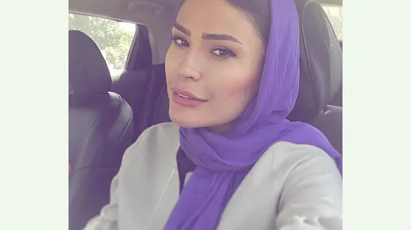 عکس صورت شوک آور شیوا طاهری ! / واقعی خانم بازیگر و ما چی می بینیم ! + 2 عکس متفاوت
