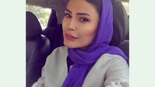 عکس صورت شوک آور شیوا طاهری ! / واقعی خانم بازیگر و ما چی می بینیم ! + 2 عکس متفاوت
