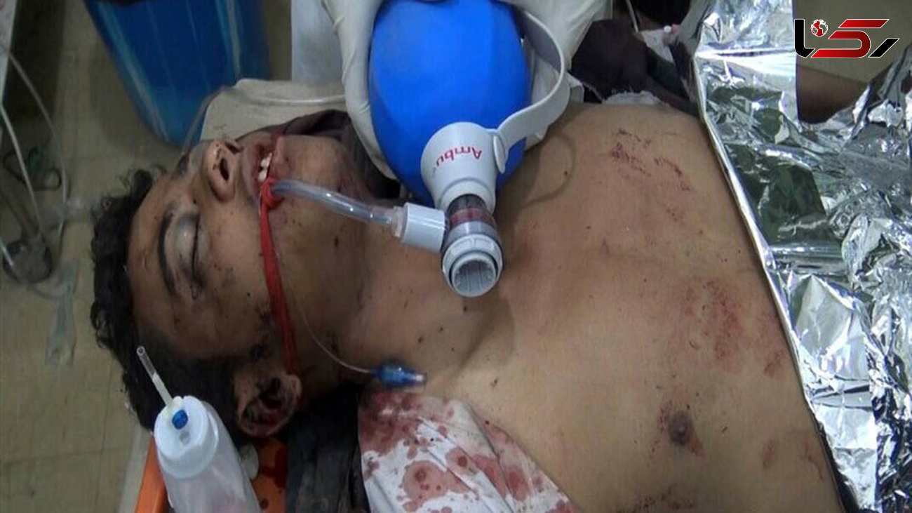 «پزشکان بدون مرز»: ائتلاف سعودی مانع ورود هواپیماهای‌مان به یمن می‌شود