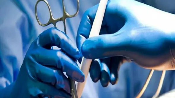 قطع شدن دست پسر 13 ساله از بازو در اهواز / اتفاقی عجیب تر رخ داد