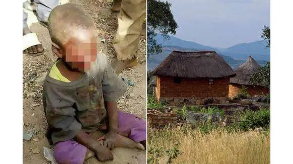 نامادری بی رحم چشم های کودک 4 ساله را از حدقه درآورد +عکس +16