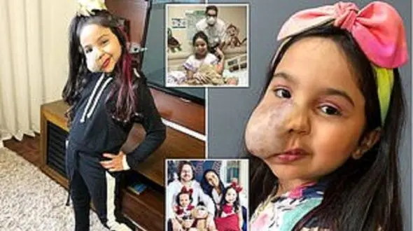 این دختر از آینه می ترسد + سرنوشتی دردناک  + عکس