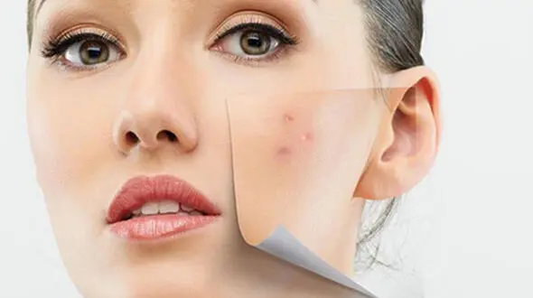 دلایل پنهان تیرگی پوست