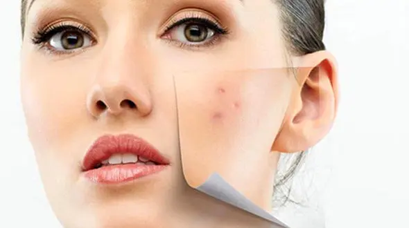 دلایل پنهان تیرگی پوست