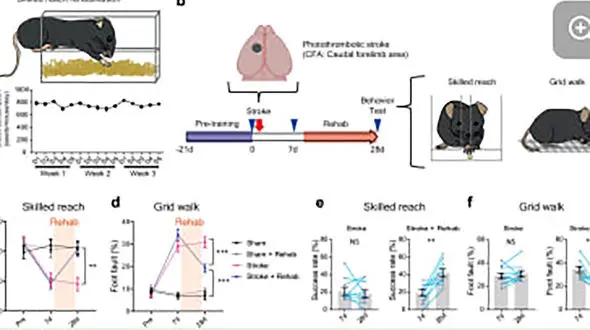 اولین داروی توان بخشی پس از سکته مغزی