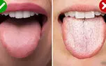 زبان سفید نشانه چیست؟ / 3 جدول مهم + پاسخ به سوالات شما