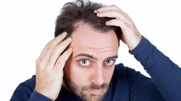 روش های فوری برای درمان موی چرب