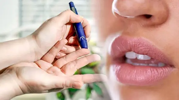 علائم دیابت در دهان