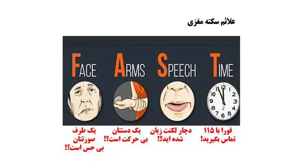 ۴علامت سکته مغزی را بشناسید